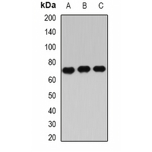 IGF2BP3 Rabbit Polyclonal Antibody