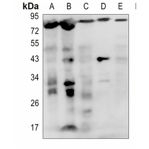 IL-1R1 Rabbit Polyclonal Antibody
