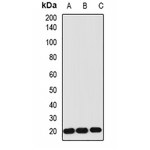 IL-1RA Rabbit Polyclonal Antibody
