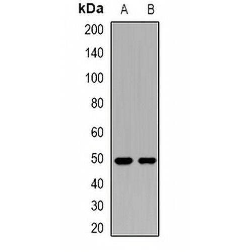 Cytokeratin 15 Rabbit Polyclonal Antibody
