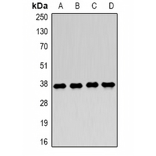 LDHA Rabbit Polyclonal Antibody