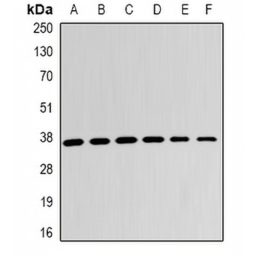 LDHB Rabbit Polyclonal Antibody