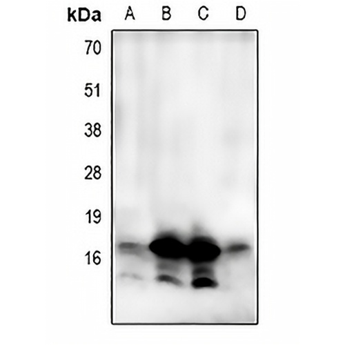 LC3A/B Rabbit Polyclonal Antibody