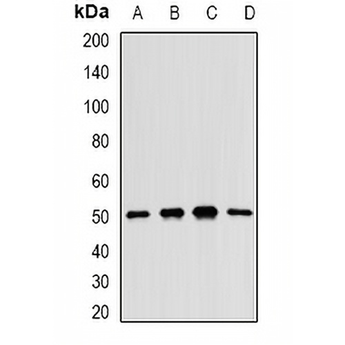 MKK5 Rabbit Polyclonal Antibody