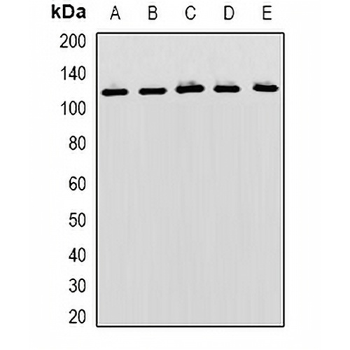MBTPS1 Rabbit Polyclonal Antibody