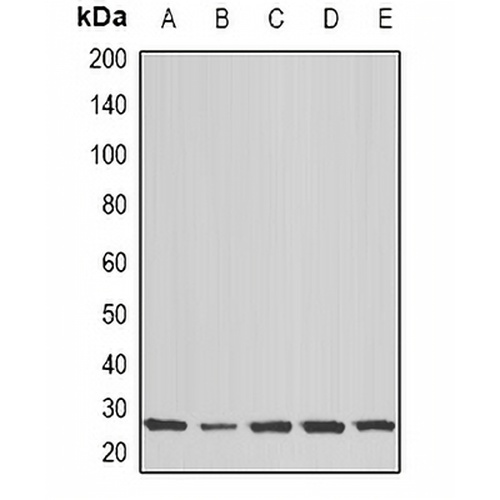 COX2 Rabbit Polyclonal Antibody