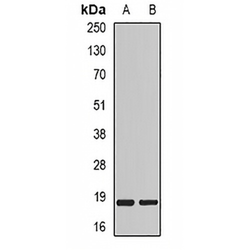 MYL2 Rabbit Polyclonal Antibody
