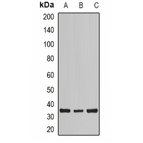 Calsarcin 1 Rabbit Polyclonal Antibody
