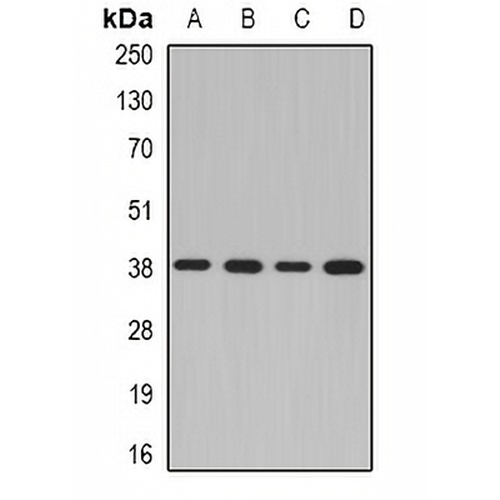 NDEL1 Rabbit Polyclonal Antibody