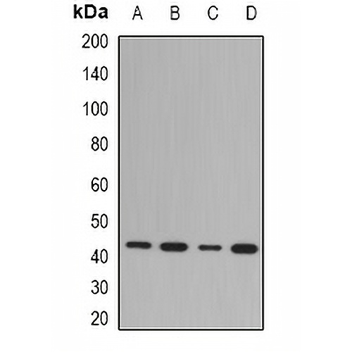 NDRG1 Rabbit Polyclonal Antibody