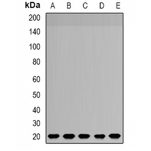 NDUFS4 Rabbit Polyclonal Antibody