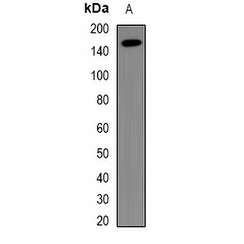 NUP155 Rabbit Polyclonal Antibody