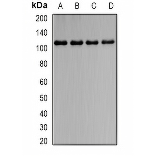 IL-31RB Rabbit Polyclonal Antibody