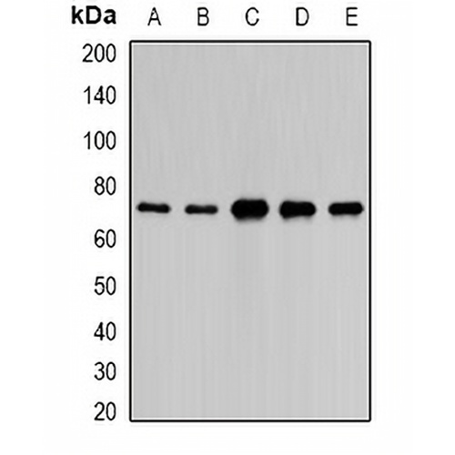 PAIP1 Rabbit Polyclonal Antibody