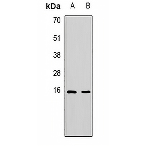 PDCD5 Rabbit Polyclonal Antibody