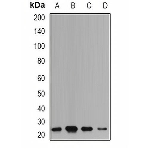 mPR Rabbit Polyclonal Antibody