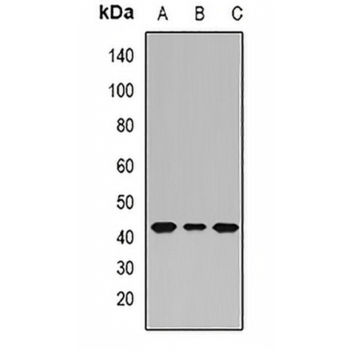 PHF6 Rabbit Polyclonal Antibody
