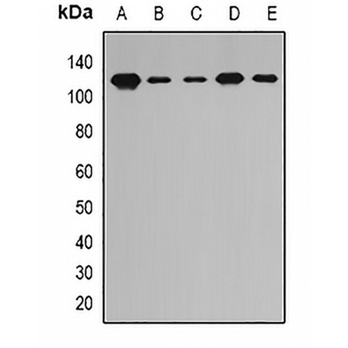 PITRM1 Rabbit Polyclonal Antibody
