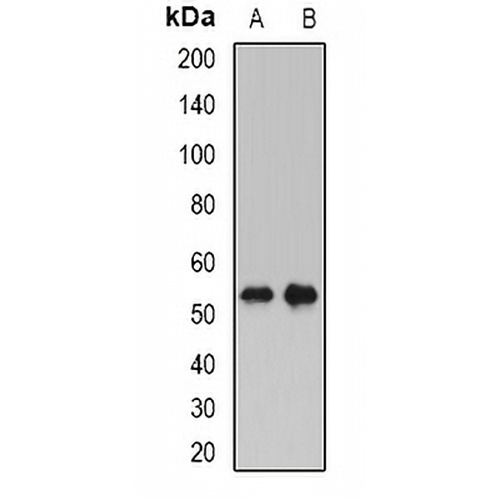 PLTP Rabbit Polyclonal Antibody