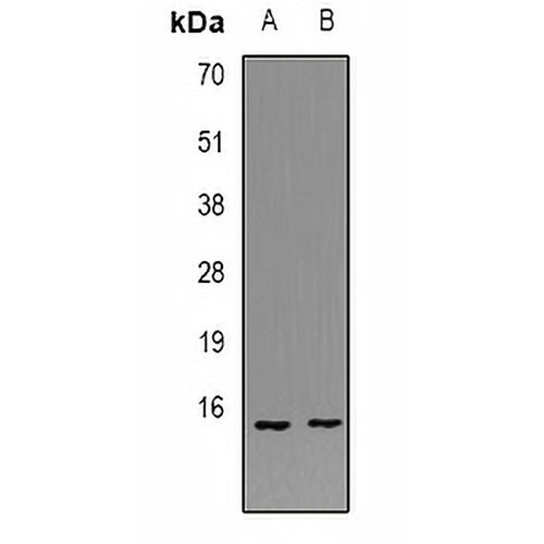 POLR1D Rabbit Polyclonal Antibody