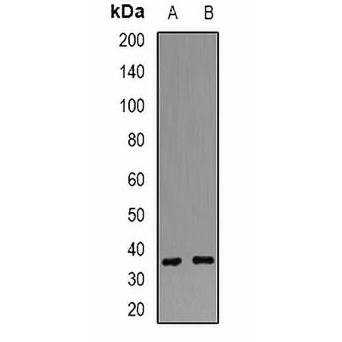 POLR2C Rabbit Polyclonal Antibody