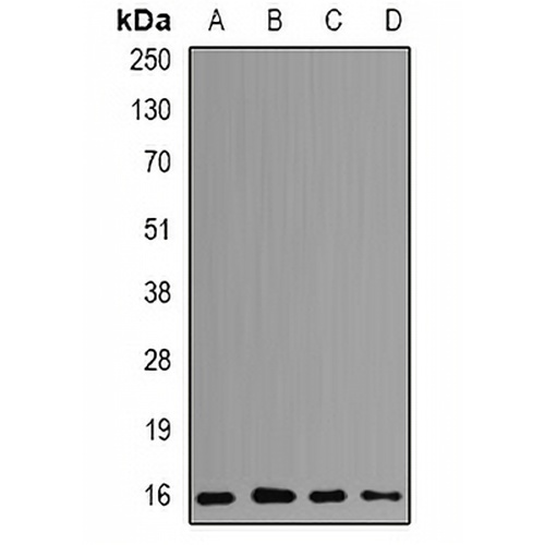POLR2D Rabbit Polyclonal Antibody