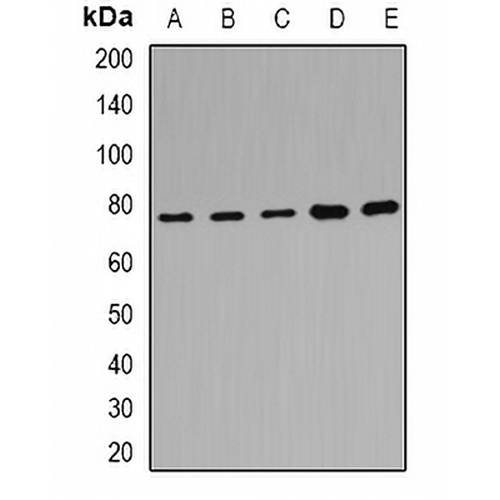 POR Rabbit Polyclonal Antibody