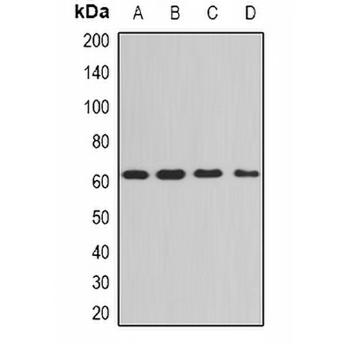 PPP3CA Rabbit Polyclonal Antibody