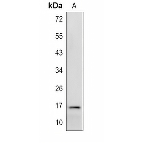 PPP3R2 Rabbit Polyclonal Antibody