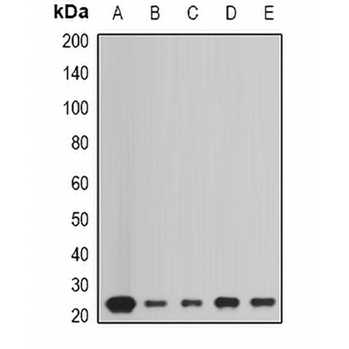Peroxiredoxin 1 Rabbit Polyclonal Antibody