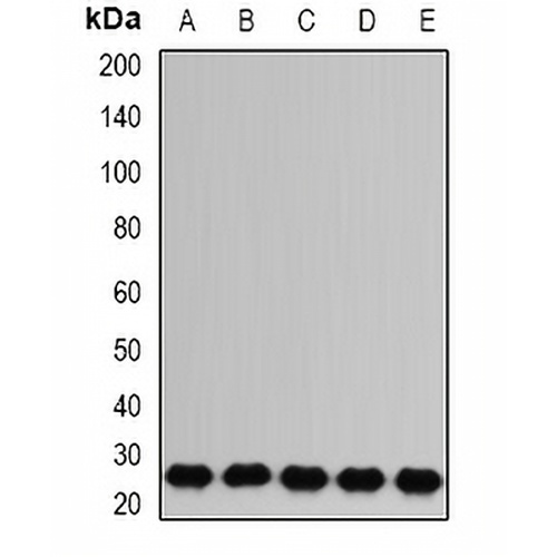 RAB17 Rabbit Polyclonal Antibody