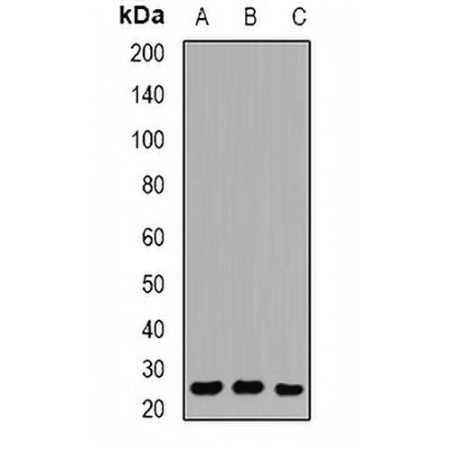 RAB27 Rabbit Polyclonal Antibody
