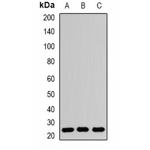RAB5A Rabbit Polyclonal Antibody