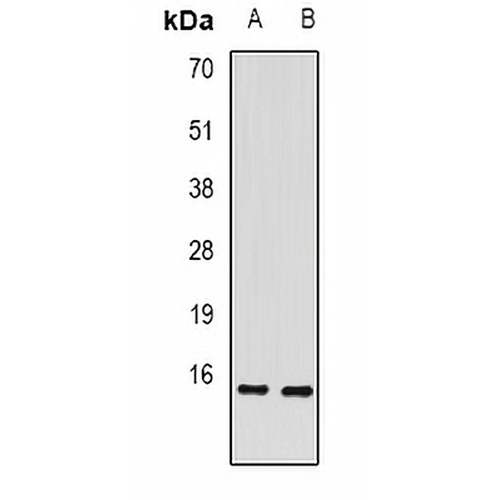 RBP2 Rabbit Polyclonal Antibody