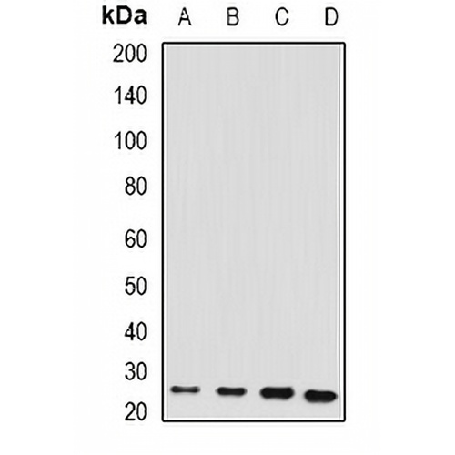 RBP4 Rabbit Polyclonal Antibody