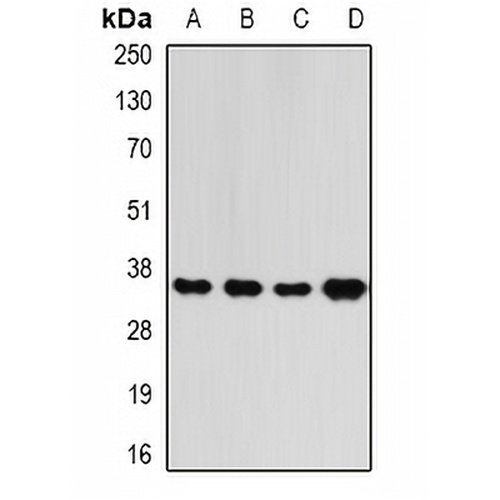 RFC5 Rabbit Polyclonal Antibody