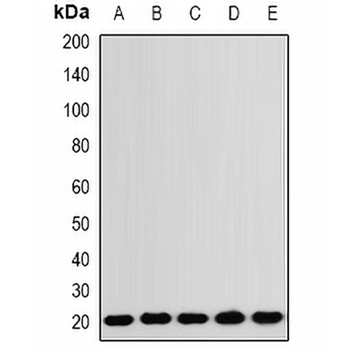 RNF5 Rabbit Polyclonal Antibody