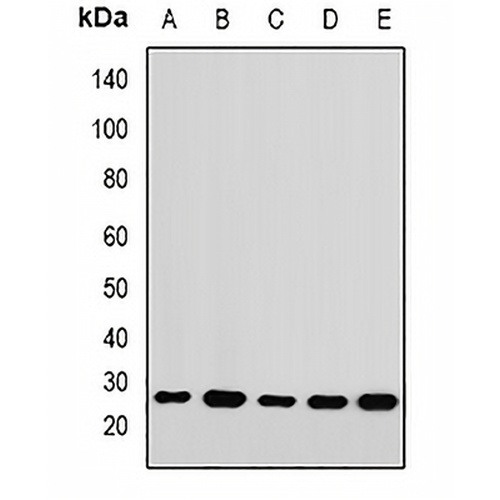 RPL14 Rabbit Polyclonal Antibody