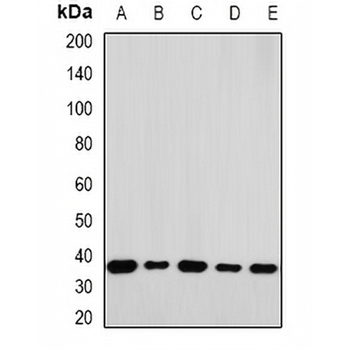 RPLP0 Rabbit Polyclonal Antibody