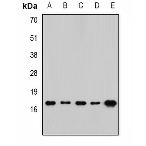 RPLP1 Rabbit Polyclonal Antibody