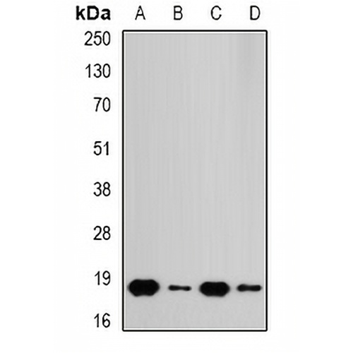 RPS10 Rabbit Polyclonal Antibody