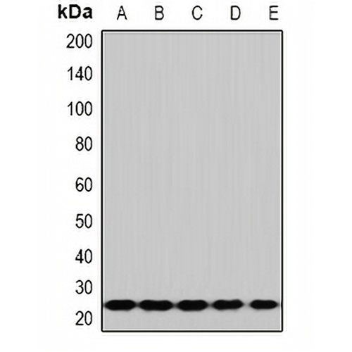 RPS5 Rabbit Polyclonal Antibody