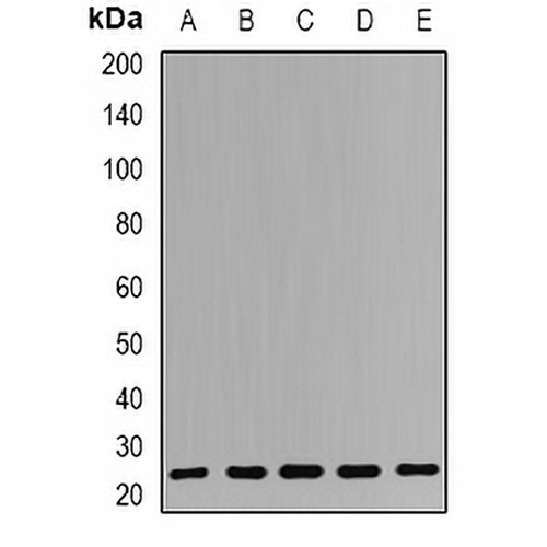 RPS7 Rabbit Polyclonal Antibody