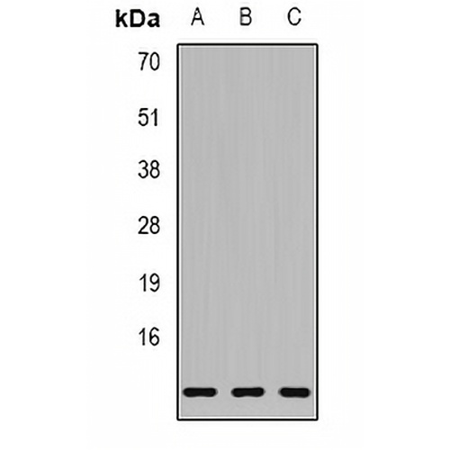 S100-A11 Rabbit Polyclonal Antibody