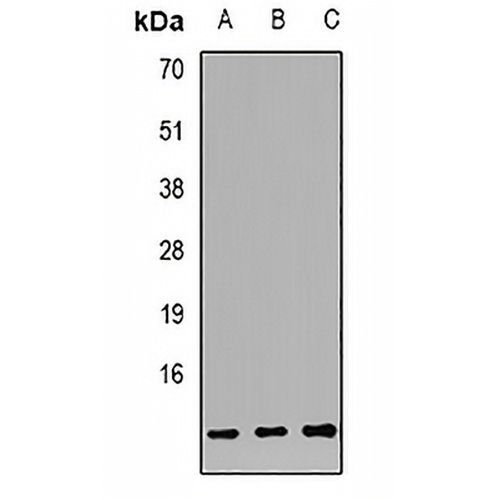 S100-A12 Rabbit Polyclonal Antibody