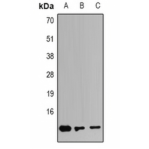 S100-A4 Rabbit Polyclonal Antibody