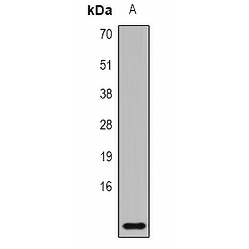 MRP8 Rabbit Polyclonal Antibody