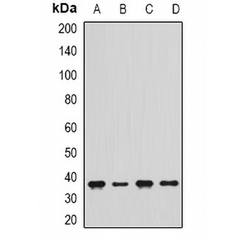 delta-Sarcoglycan Rabbit Polyclonal Antibody