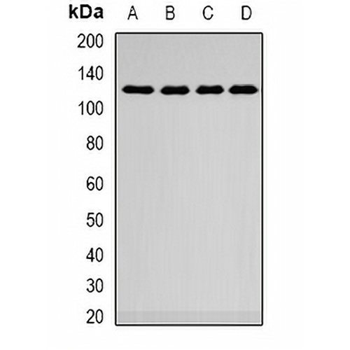 SMARCAD1 Rabbit Polyclonal Antibody