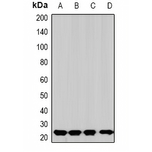 SOD2 Rabbit Polyclonal Antibody